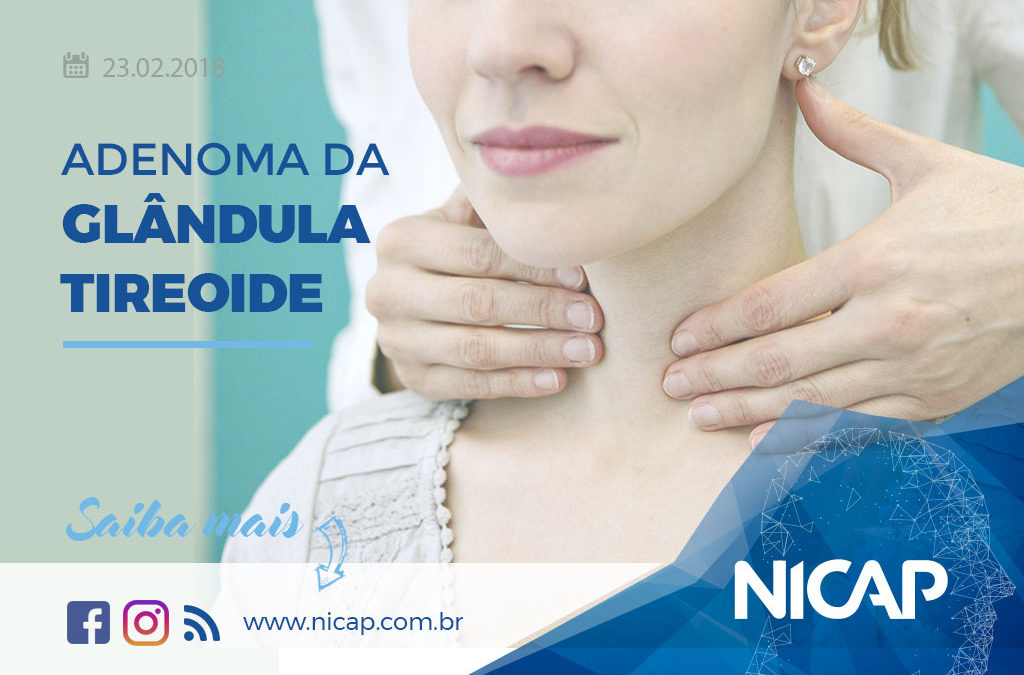 ADENOMA DA GLÂNDULA TIREOIDE