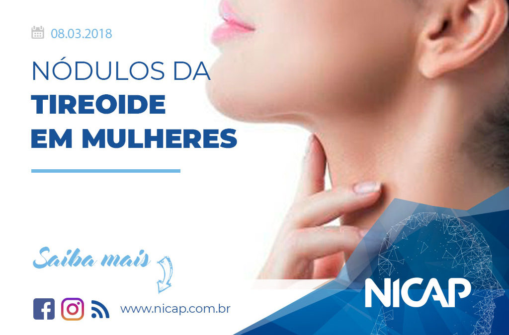 Nódulos da Tireoide em Mulheres