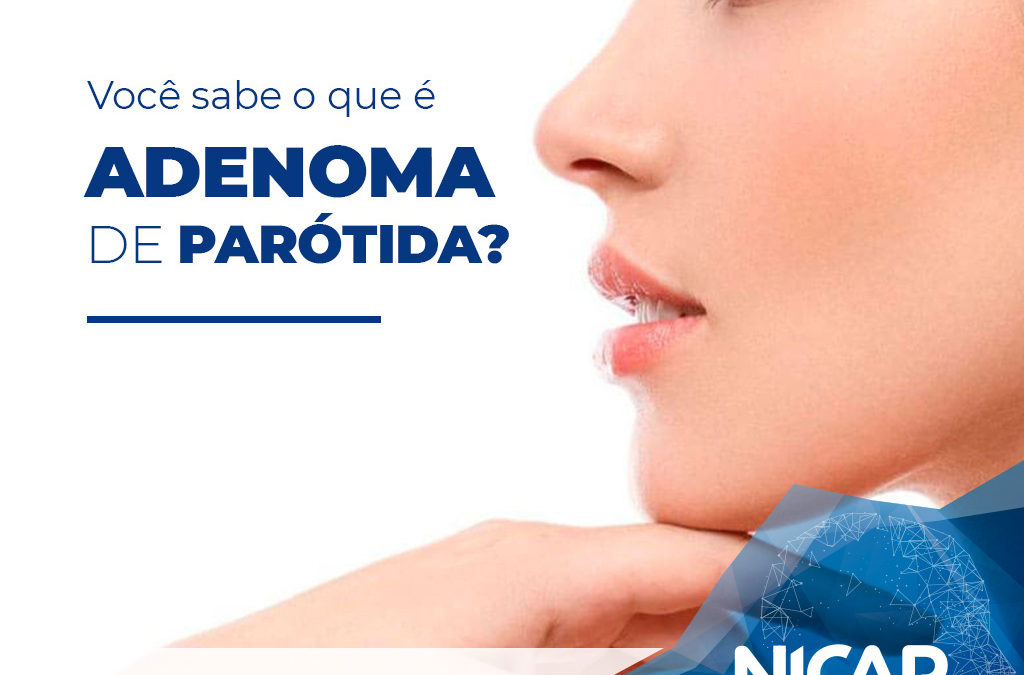 Você sabe o que é Adenoma de Parótida?