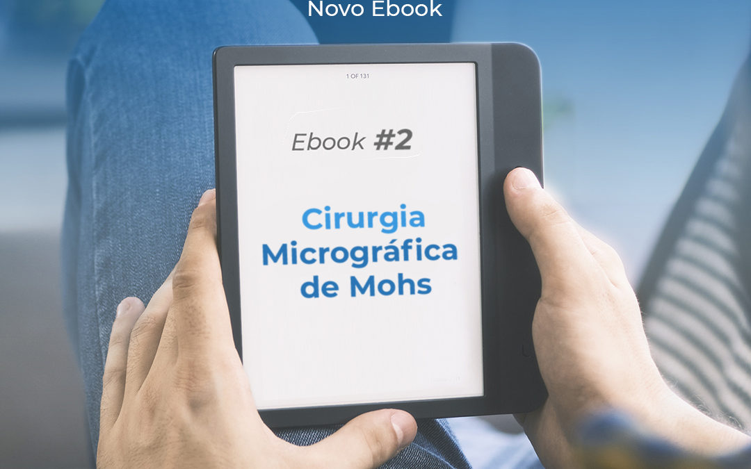 Novo Ebook: Cirurgia Micrográfica de Mohs