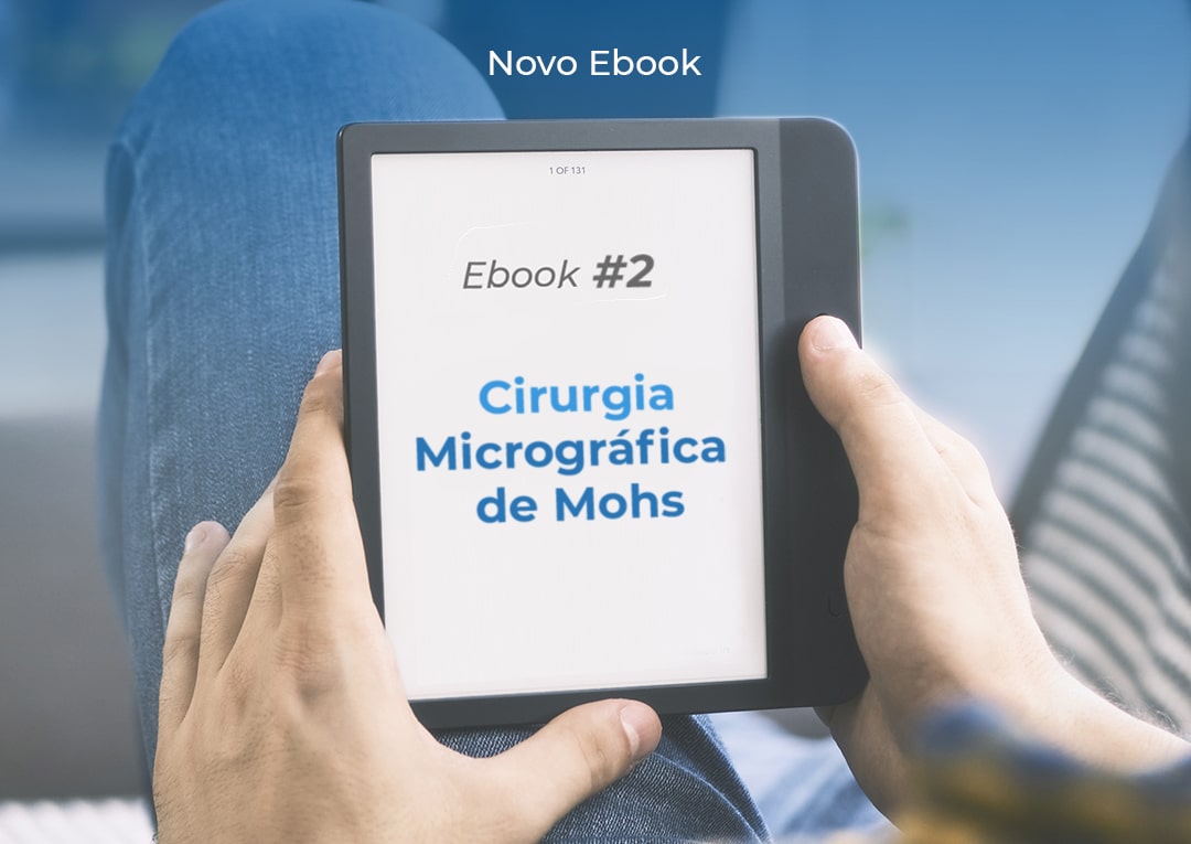 Novo Ebook: Cirurgia Micrográfica de Mohs