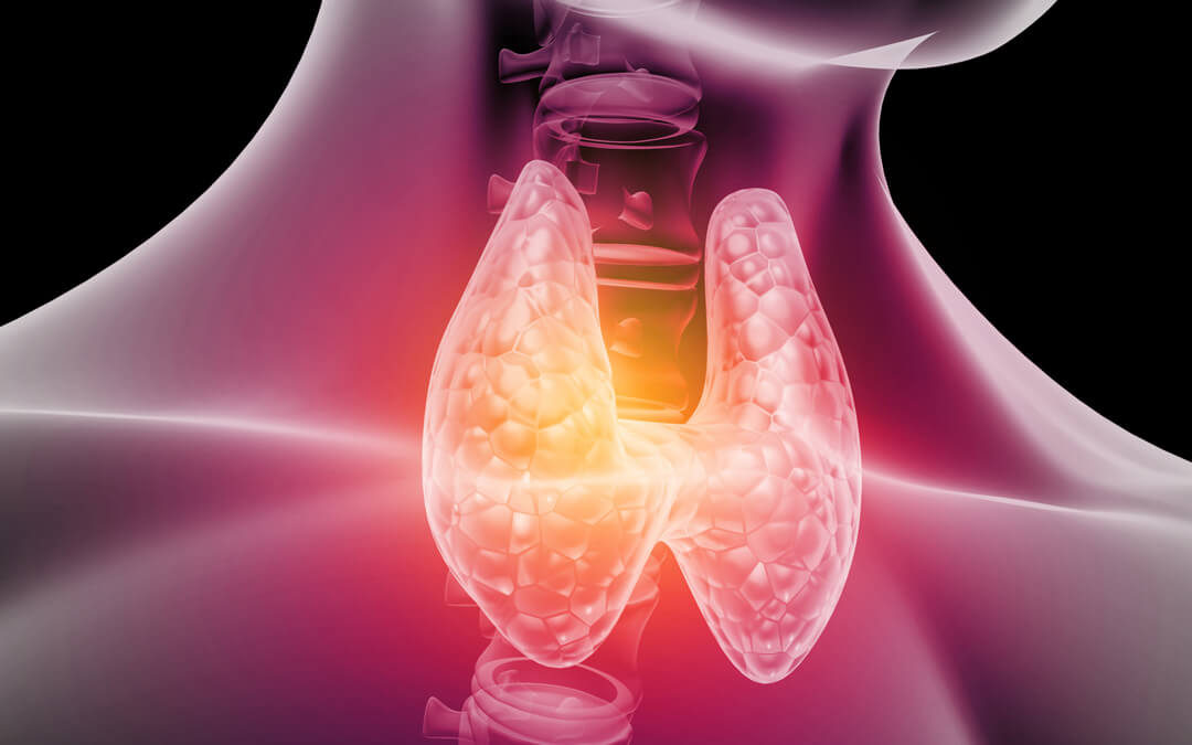 Nódulo de tireoide: como conduzir o diagnóstico correto?