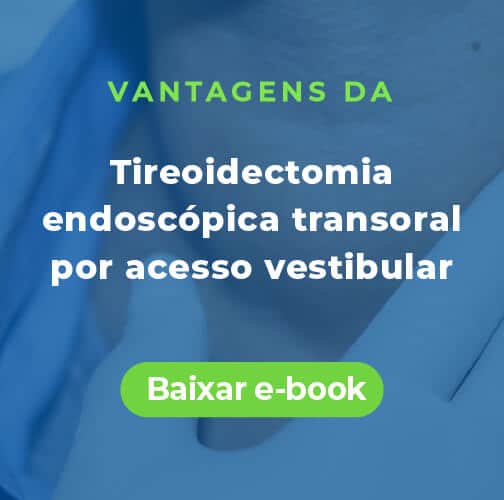ebook tireoidectomia endoscopica transoral por acesso vestibular
